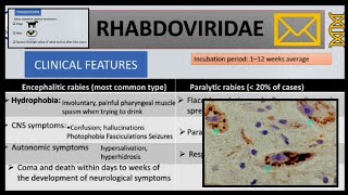 Rabies  cause pathogenesisclinical manifestations diagnosis and prophylaxis [upl. by Lippold939]