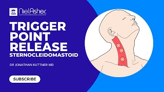 Trigger Point Therapy  Sternocleidomastoid SCM [upl. by Sirois]