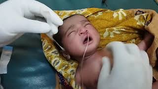 Nasogastric NGTube Insertion Suctioning NeonateNewbornOrogastricOGTube Feeding TubePaediatric [upl. by Kessiah637]