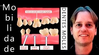 Periodontites Gengivites e Dentes Moles  Técnica Ninja para Evitar e Tratar em Casa [upl. by Murray49]