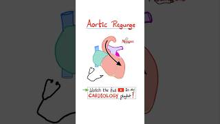 Aortic Regurgitation AR  Valvular Heart Disease VHD…biology science cardiology anatomy [upl. by Angelika]