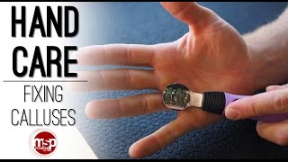 Fixing Calluses  Proper Hand Care for Weight Training  TECHNIQUE HUB [upl. by Ennoirb575]