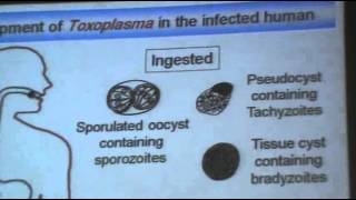 DrAzaa 10  Toxoplasmosis [upl. by Adnamma]