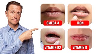 5 Things Your LIPS Can Tell You about Your Nutritional State [upl. by Ayanaj]