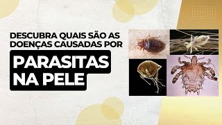 Descubra quais são as doenças causadas por parasitas na pele [upl. by Llertak829]