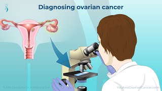 Diagnosing Ovarian Cancer [upl. by Im]