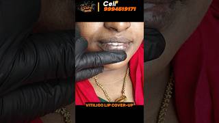 Vitiligo lips vitiligo treatment in trichy best method vitiligo treatment best tattoo studio [upl. by Christa944]