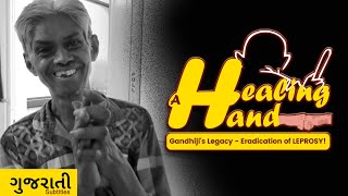 A Healing Hand Gandhijis Legacy  Eradication of Leprosy  Dr KM Acharya A Film by SachinMankad [upl. by Marra396]