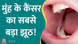 Oral Cancer यानी मुंह का कैंसर सिर्फ़ तंबाकू खाने वालों को होता है  Sehat ep 561 [upl. by Elbert]