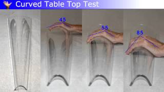 Measurement of Dupuytren Disease [upl. by Roinuj128]