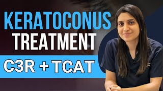 Treatment Of Keratoconus C3R TCAT C3R [upl. by Nai]