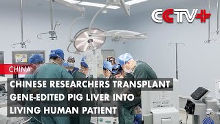 Chinese Researchers Transplant Geneedited Pig Liver into Living Human Patient [upl. by Irpak130]