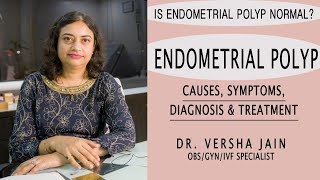 Endometrial Polyps कारण समस्याएं एव निदान  Do endometrial polyps need to be removed [upl. by Emyle498]