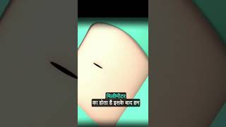 चलिए देखते हैं कैसे होती है हार्ट की एंजियोग्राफीAnimated Heart Angiography Procedure [upl. by Cassidy]