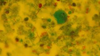 Entamoeba coli  trophozoite [upl. by Elwina]