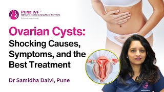 Ovarian Cysts Shocking Causes Symptoms and the Best Treatment  Dr Samidha Dalvi  Pune IVF [upl. by Sundberg]