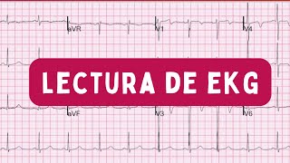 E10  LECTURA DE EKG Integración  Cardiología [upl. by Halsted]