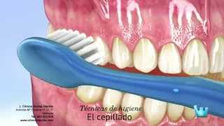 Cepillado seda dental y colutorios ¿cómo [upl. by Siurad]