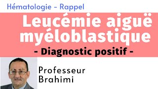 Leucémie Aiguë Myéloblastique Diagnostic positif [upl. by Fredella]