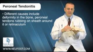 Peroneal Tendinitis is a Common Running Injury [upl. by Welcome115]