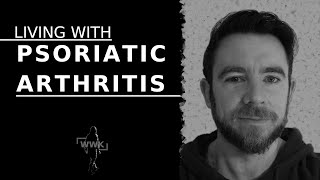 Living with Psoriatic Arthritis  Symptoms Diagnosis Impact on your life amp Treatment [upl. by Esenaj325]