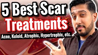 5 BEST Products for Scars  How to Get RID of Scars All Types [upl. by Hgielrahc]