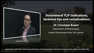 Dorsolateral TLIF Indication technical tips and complications [upl. by Nehttam]