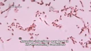 Fusobacterium amp Infections [upl. by Schechinger32]