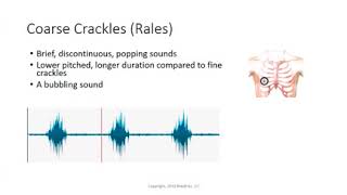 Coarse crackles Rales Lung Sounds [upl. by Helyn26]