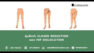 OT008 หุ่นฝึกการทำ Closed Reduction ของ Hip Dislocation  Hip Dislocation Model [upl. by Oira898]