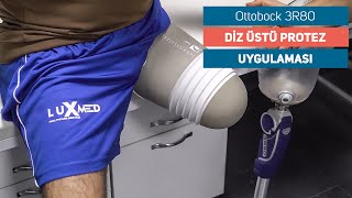 Diz Üstü Protez Uygulama Ottobock 3R80  Luxmed Protez [upl. by Teodorico]