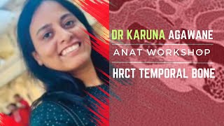 KARUNA AGAWANE  HRCT TEMPORAL BONE workshop [upl. by Assena]