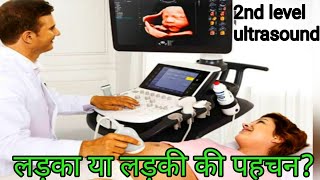 🤱🥰Ultrasound se Jane ladka ya ladkiSonography se kaise Jane ladka hai ya ladki2nd level ultrasound [upl. by Alhan]