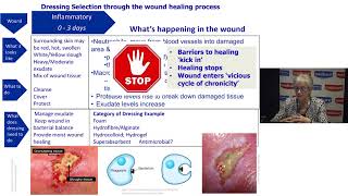 Understanding Wound Dressings Categories and Indications [upl. by Benny351]