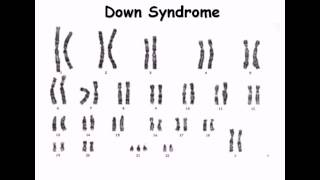 8 Karyotype [upl. by Nykal]