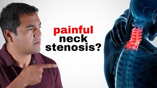 10 Things You Should AVOID if You Have Neck Cervical Stenosis [upl. by Ephrem]