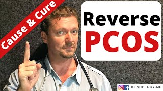 PCOS What Causes PCOS How to Reverse PCOS [upl. by Pruchno]