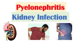 Pyelonephritis Kidney Infection  Causes Pathophysiology Signs amp Symptoms Diagnosis Treatment [upl. by Karlise957]