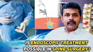 Is Endoscopic Treatment Possible in Spine Surgery Dr Vignesh Pushparaj [upl. by Homer5]