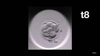 MIRI® TL  TimeLapse Annotation of an Embryo  Esco Medical [upl. by Lammaj]