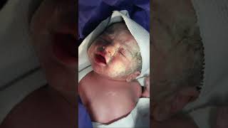 My newborn baby with Vernix Caseosa Just after birth cutebabyboy baby babyborn newbornbaby [upl. by Willet433]