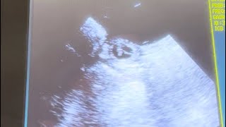 French Bulldog Pregnancy Stages  Day 27 Dog Pregnancy Confirmation Ultrasound [upl. by Breena]