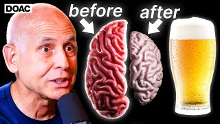 The Ugly Truth About Alcohol’s Effect On Your Brain  Dr Daniel Amen [upl. by Darooge]