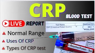 CRP Blood Test 💉 C  reactive Protein 💉 CRP Live report Understand [upl. by Otrebliw952]