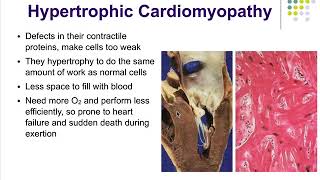 Pathophysiology Ch18 Alterations in Cardiac Function [upl. by Seidnac133]