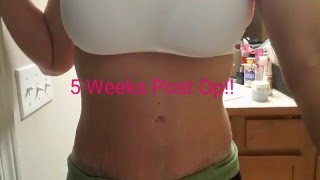 Mommy Makeover Secrets to Healing Well 5 weeks post op [upl. by Nilved598]