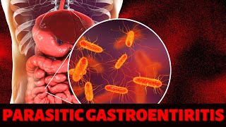 PARASITIC GASTROENTIRITIS [upl. by Norina]