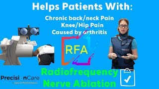 Radiofrequency Nerve Ablation RFA  Back and Neck Pain Treatment [upl. by Nivlad]