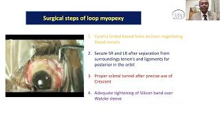 Lecture The Surgical Management of Myopic Strabismus Fixus [upl. by Rene]