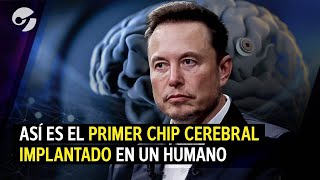 Cómo funciona TELEPATHY EL CHIP CEREBRAL que una empresa de ELON MUSK implantó en un HUMANO [upl. by Bay]